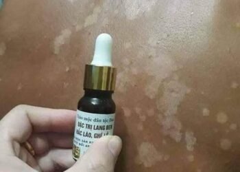 Đặc trị bệnh bạch biến ,lang ben    
 Thuốc đông y gia truyền chuyên đặc trị bện...