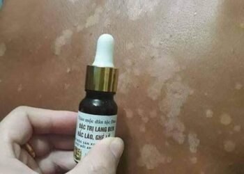 Đặc trị bệnh bạch biến ,lang ben    
 Thuốc đông y gia truyền chuyên đặc trị bện...